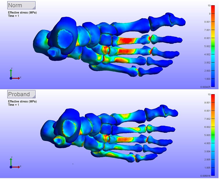 Finite Element Analyse